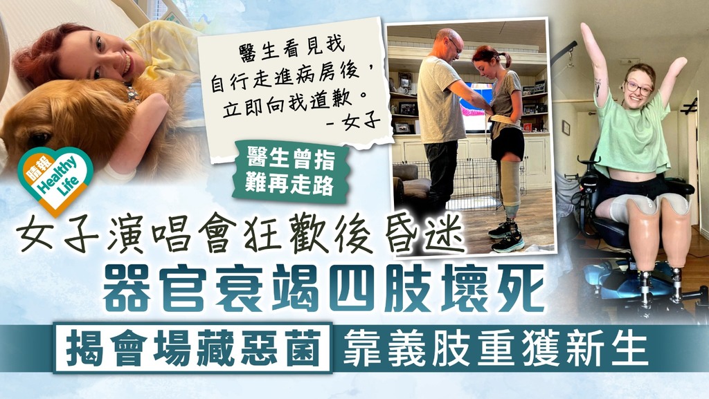 生命奇迹｜女子演唱會狂歡後昏迷 器官衰竭四肢壞死 揭會場藏惡菌靠義肢重獲新生 