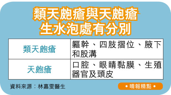 長者皮膚痕出疹生水泡 或患類天皰瘡 - 晴報 - 港聞 - Healthy Life - D230428