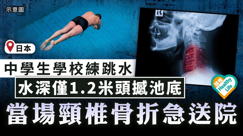 泳池意外｜日本中學生學校練跳水 水深僅1.2米頭撼池底 當場頸椎骨折急送院
