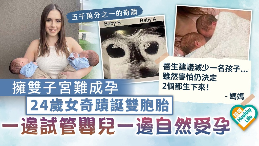 天賜禮物︳擁雙子宮難成孕 24歲女奇蹟懷孕誕雙胞胎 一邊試管嬰兒一邊自然受孕