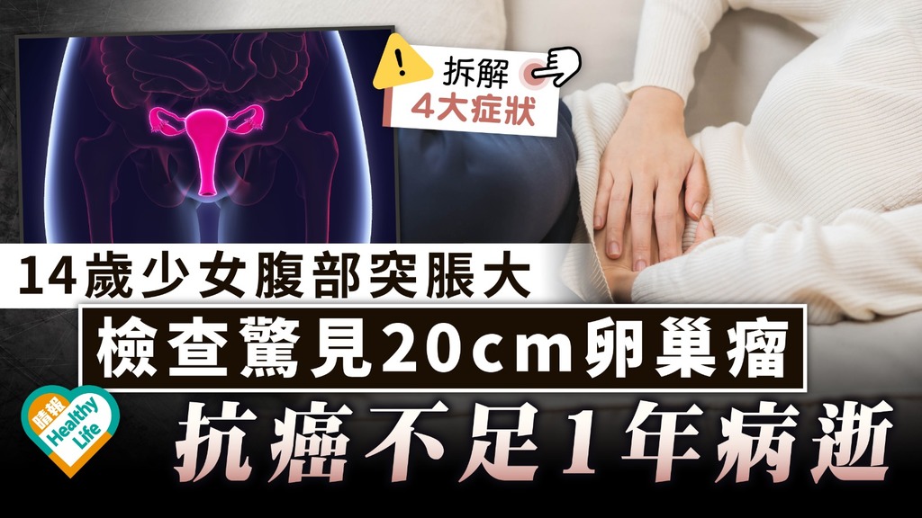 女士注意︳14歲少女腹部突脹大 求醫檢查驚見20cm卵巢瘤 抗癌不足1年病逝