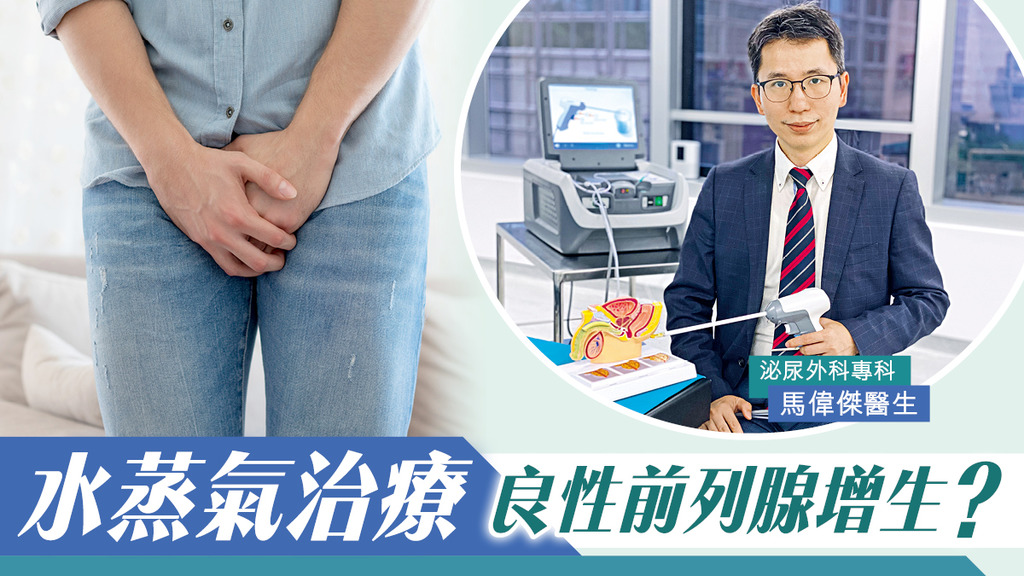 水蒸氣治療 良性前列腺增生？