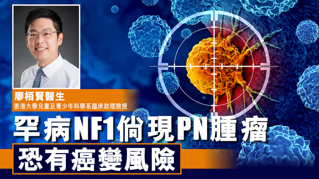 罕病NF1倘現PN腫瘤 恐有癌變風險