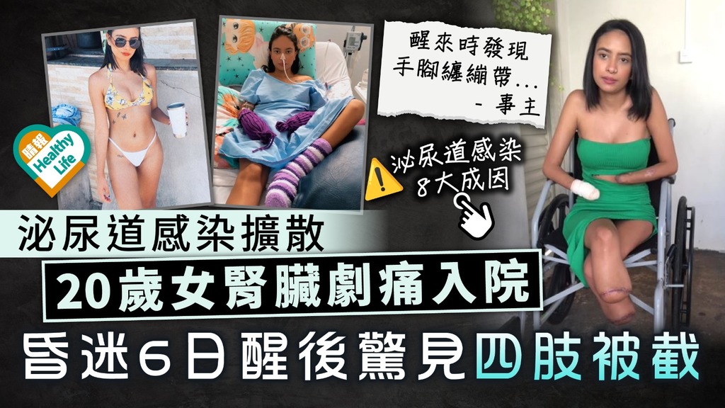 細菌感染｜泌尿道感染擴散 20歲女腎臟劇痛入院 昏迷6日醒後驚見四肢被截