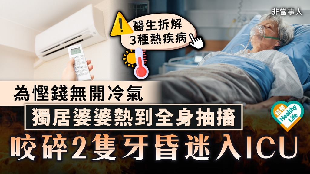熱痙攣｜為慳錢無開冷氣 獨居婆婆熱到全身抽搐 咬碎2隻牙昏迷入ICU