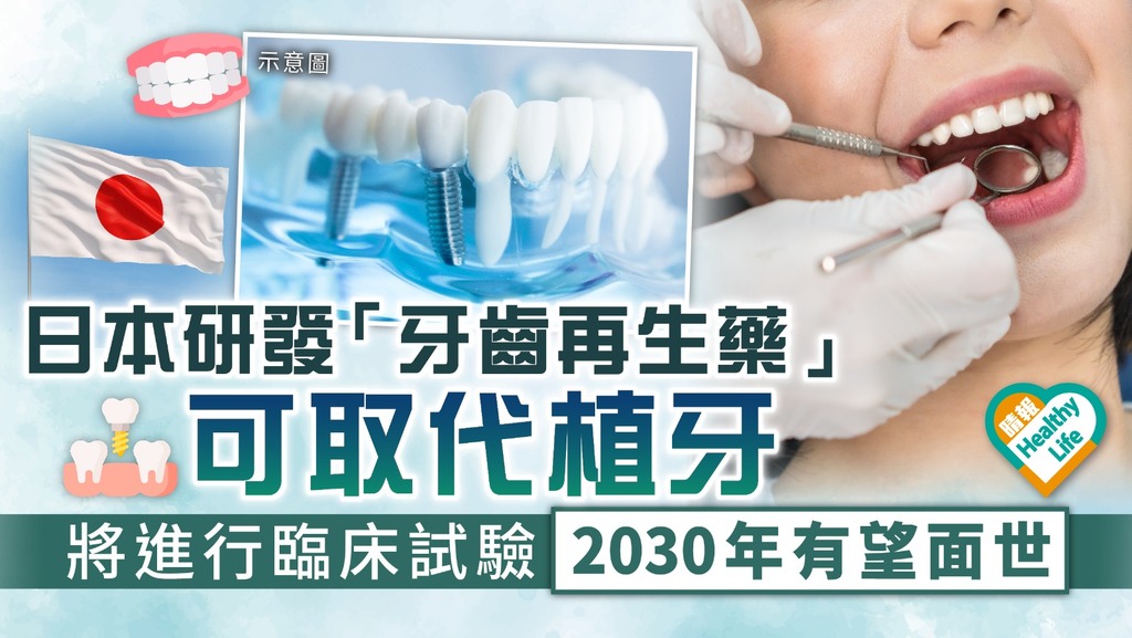 牙齒重生｜日本研發「牙齒再生藥」可取代植牙 將進行臨床試驗2030年有望面世