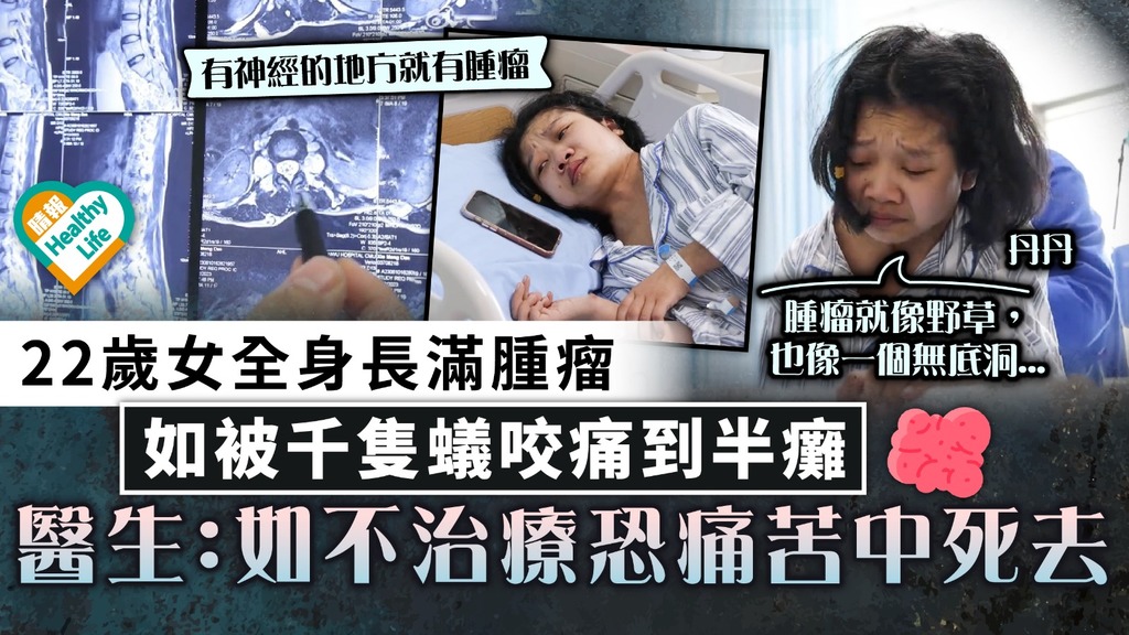 罕見疾病｜全身長滿千顆腫瘤 22歲女如被蟻咬痛到半癱 醫生：如不治療恐痛苦中死去