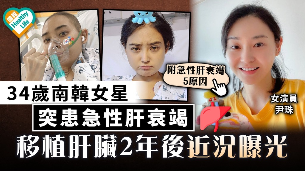 藥物副作用｜34歲南韓女星患急性肝衰竭 移植肝臟2年後近況曝光｜附急性肝衰竭5成因