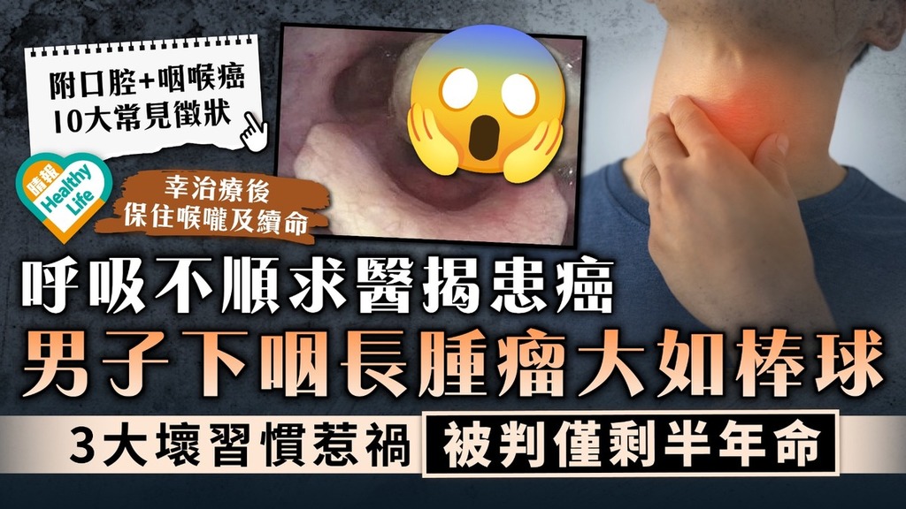 健康警號｜男子呼吸不順求醫揭患癌 下咽長腫瘤大如棒球 醫生：只剩半年命｜附口腔+咽喉癌10大徵狀