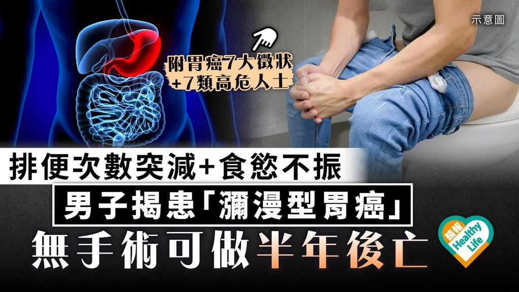 癌症殺手｜排便次數突減+食慾不振 男子揭患「瀰漫型胃癌」 無手術可做半年後亡