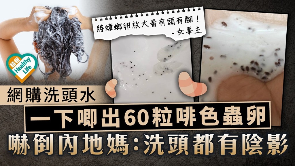 蟲卵洗頭｜網購洗頭水 一下唧出60粒啡色蟲卵 嚇倒內地媽：洗頭都有陰影
