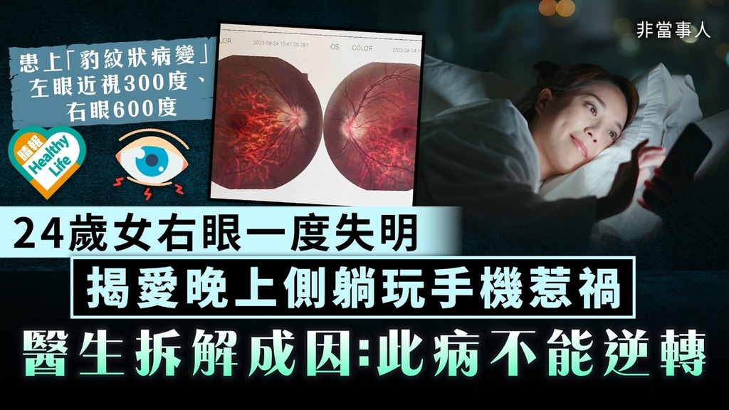 失明危機｜24歲女右眼一度失明 揭長期晚上側躺玩手機惹禍 醫生拆解成因：此病不能逆轉