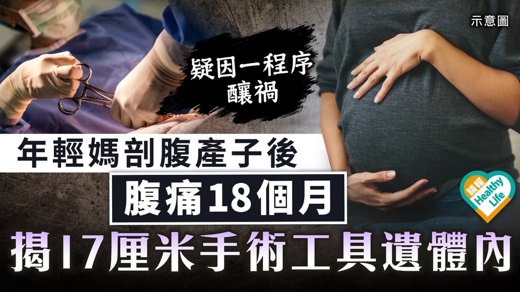 醫療事故｜新西蘭年輕媽剖腹產子後腹痛18個月 揭17厘米手術工具遺體內