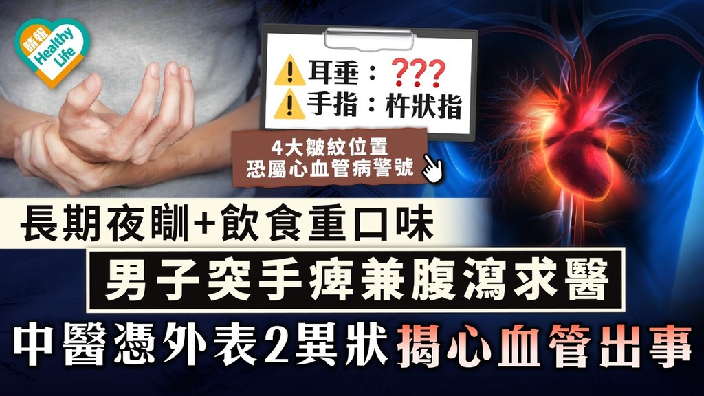 心臟警號｜長期夜瞓+飲食重口味 男子突手痺兼腹瀉求醫 中醫憑外表2異狀揭心血管出事
