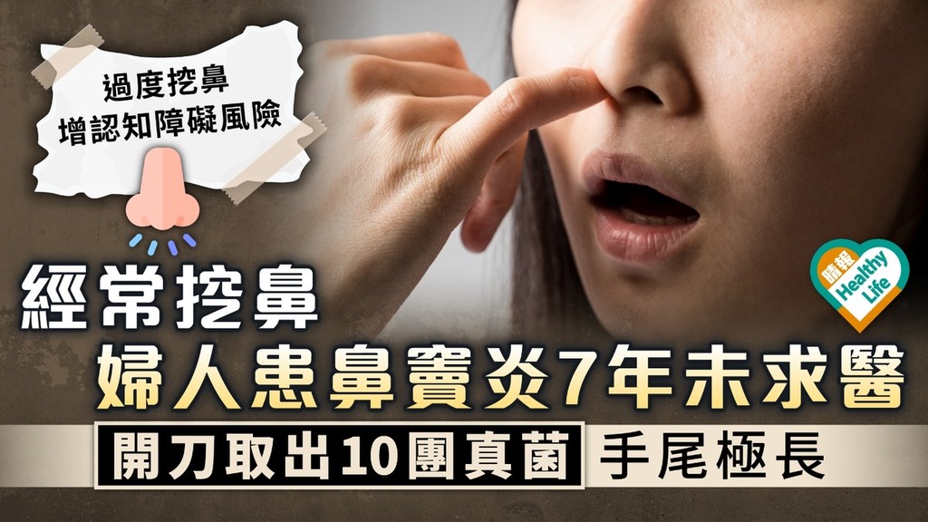 個人衛生｜經常挖鼻婦人患鼻竇炎7年未求醫 開刀取出10團真菌手尾極長
