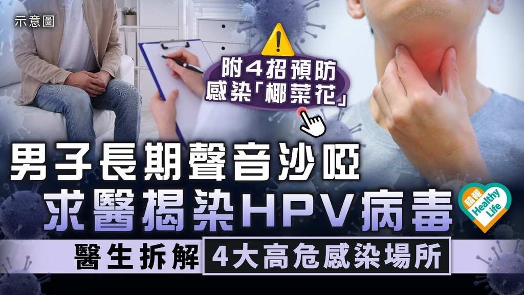 HPV病毒｜男子長期聲音沙啞 求醫揭染HPV病毒 醫生拆解4大高危感染場所