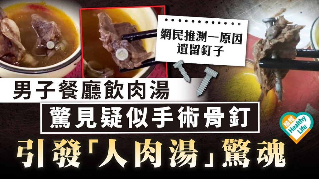 細思極恐｜男子餐廳飲肉湯 驚見疑似手術骨釘 引發「人肉湯」驚魂