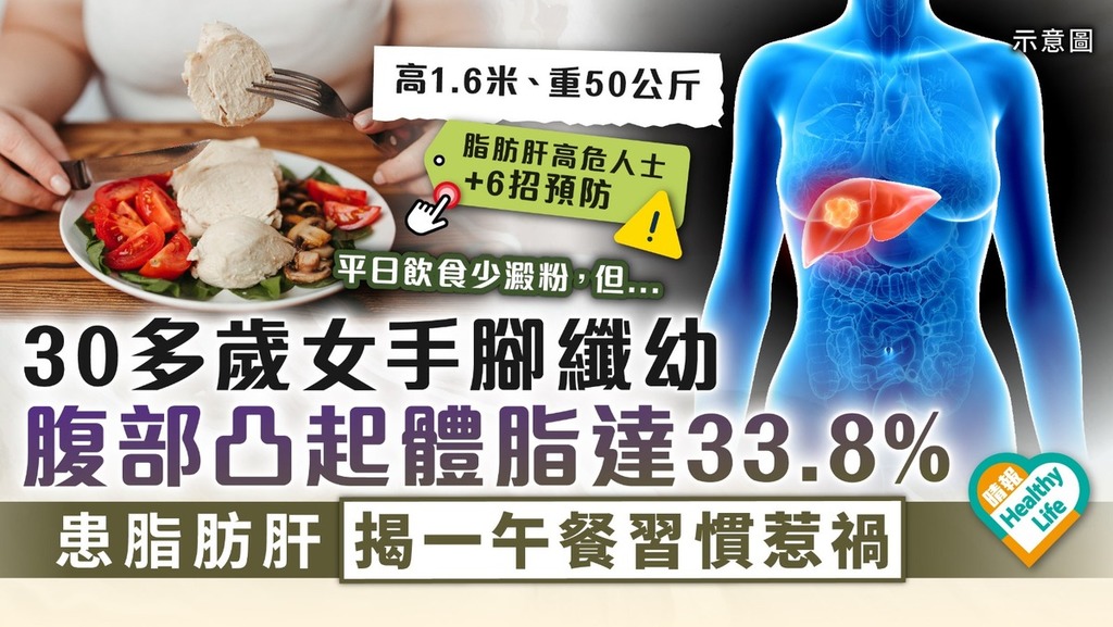 不良飲食｜30多歲女50公斤重手腳纖幼 腹部凸起體脂高達33.8% 患脂肪肝揭一午餐習慣惹禍