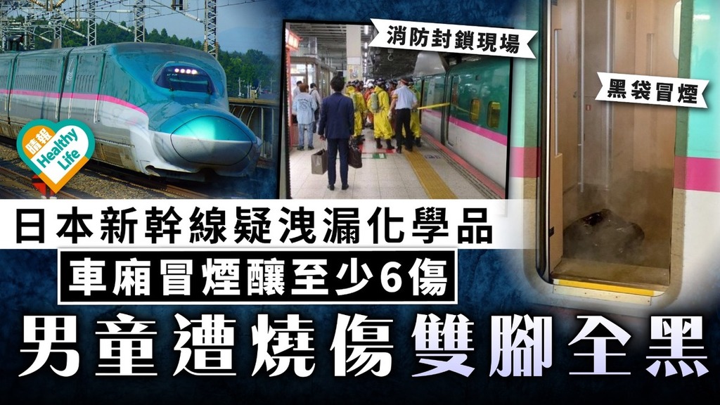 化學燒傷｜日本新幹線疑洩漏化學品 車廂冒煙釀至少6傷 男童遭燒傷雙腳全黑