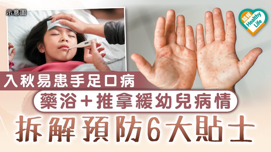 兒童健康︳幼兒入秋易患手足口病 藥浴＋推拿紓緩病情 拆解預防6大貼士