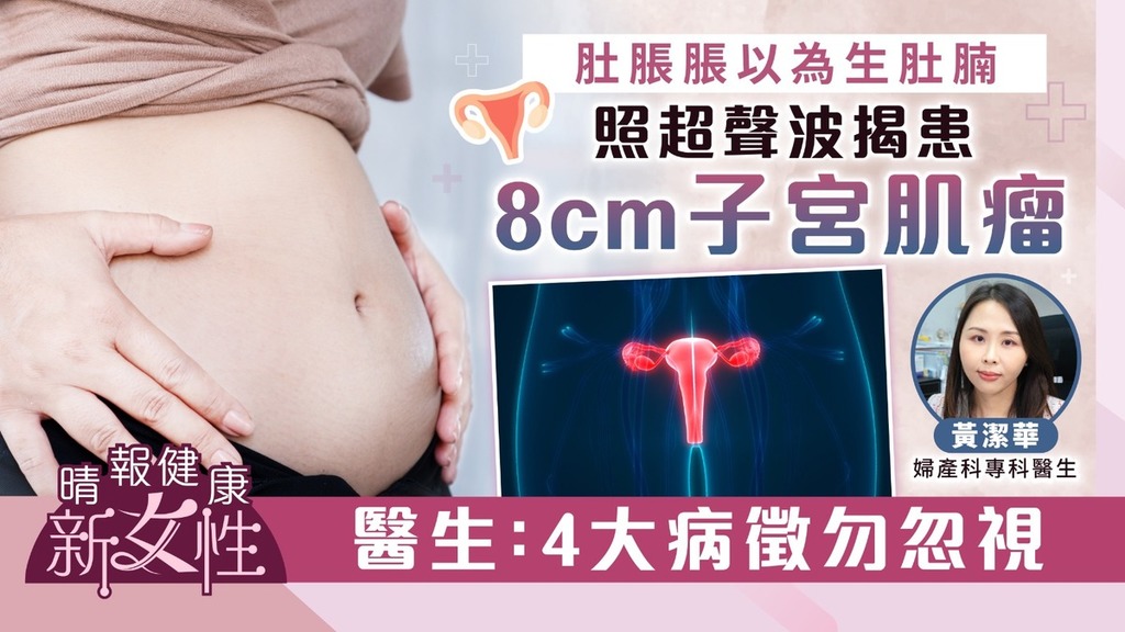 健康新女性｜肚脹脹以為生肚腩 照超聲波揭患8cm子宮肌瘤 醫生：4大病徵勿忽視