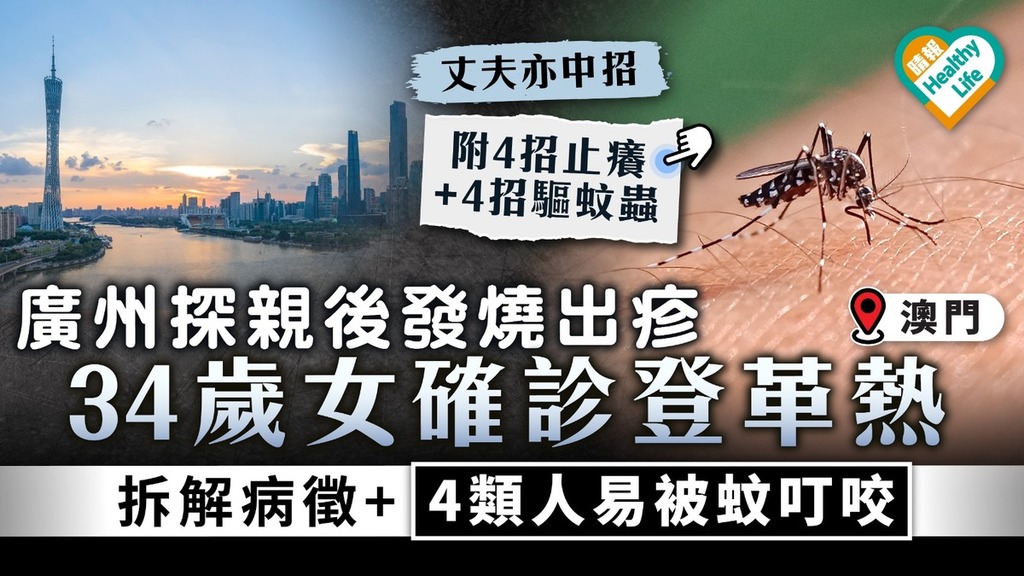 北上注意｜廣州探親後發燒出疹 34歲澳門女確診登革熱 拆解病徵+4類人易被蚊叮咬