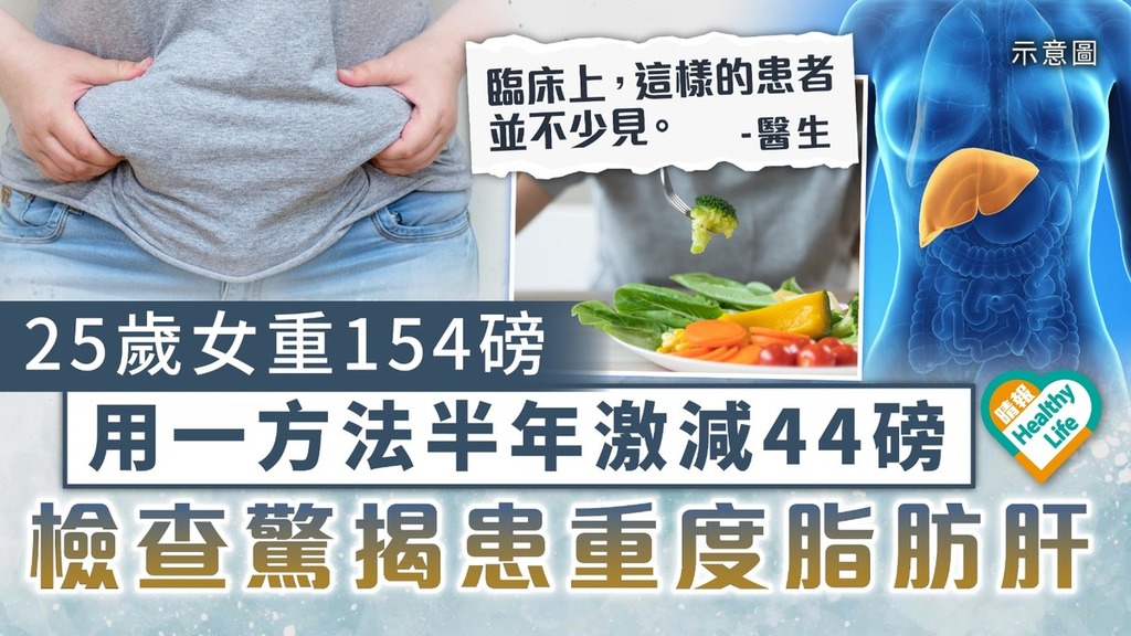 過度減肥｜25歲女重154磅 用一方法半年激減44磅 檢查驚揭患重度脂肪肝 