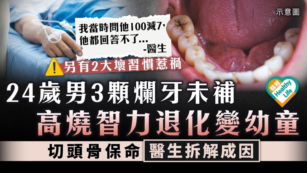 蛀牙危機｜24歲男3顆爛牙未補 高燒智力退化變幼童 切頭骨保命醫生拆解成因