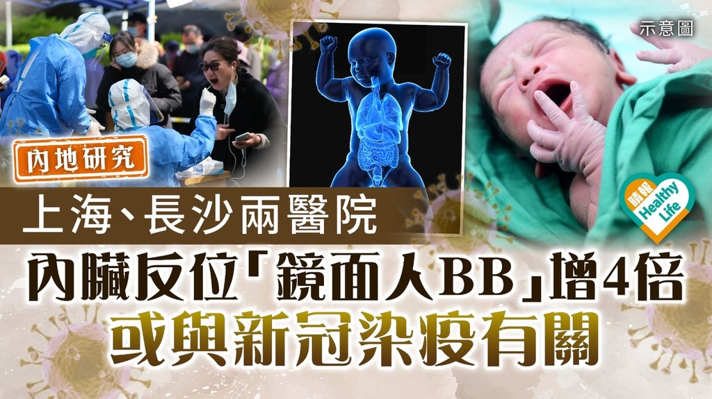 疫後嬰兒｜上海、長沙兩醫院 內臟反位「鏡面人BB」增4倍 內地研究：或與新冠染疫有關