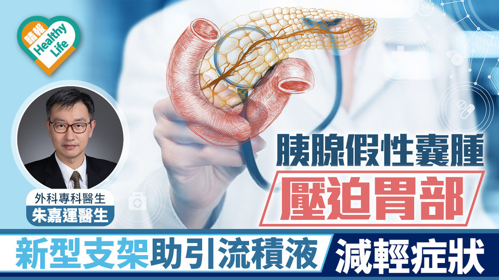 胰腺假性囊腫 壓迫胃部 新型支架助引流積液 減輕症狀