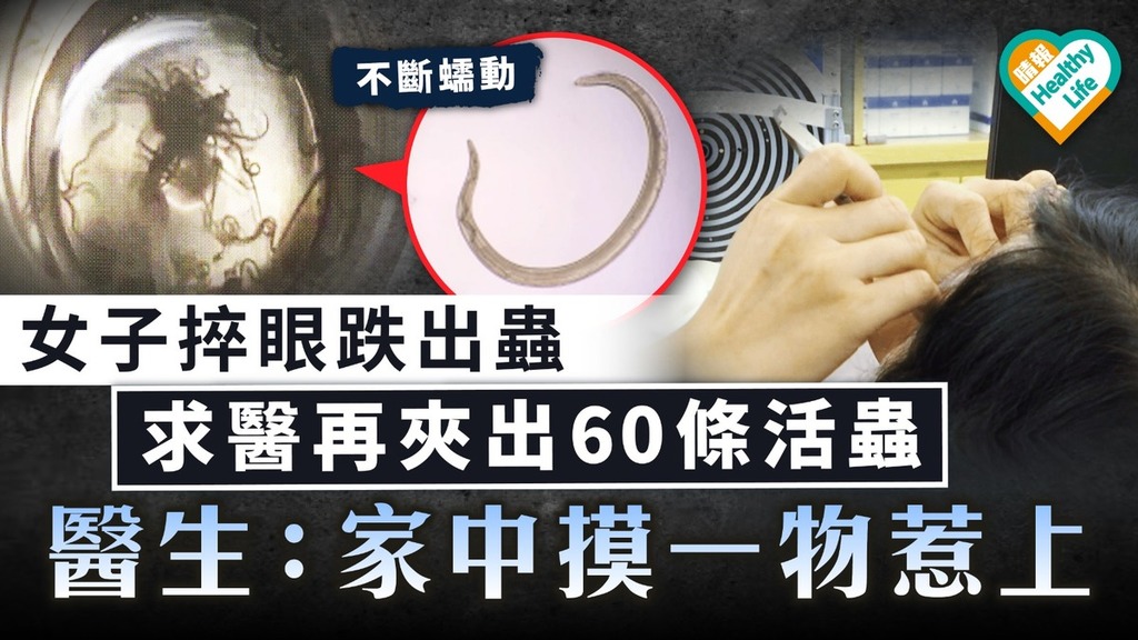 Terrifying case｜A woman opened her eyes and fell out of the worms. She sought medical treatment and picked out 60 live worms. Doctor: Touching something in the house and got it – Qingbao – Health – Living Healthy