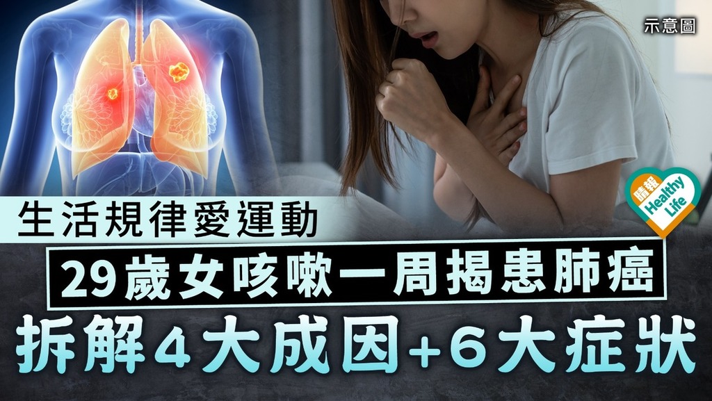 癌症殺手｜生活規律愛運動 29歲女咳嗽一周揭患肺癌 拆解4大成因+6大症狀