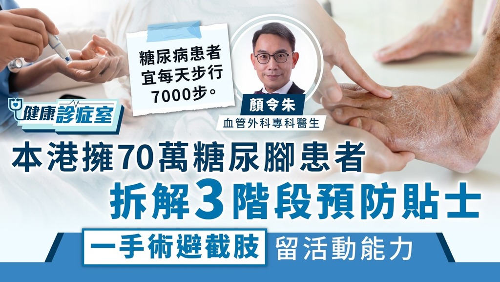 健康診症室｜本港擁70萬糖尿腳患者 拆解3階段預防貼士 一手術避截肢留活動能力