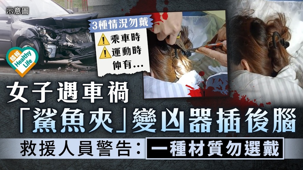 恐怖意外｜女子遇車禍 「鯊魚夾」變兇器插後腦 救援人員警告：一種材質勿選戴