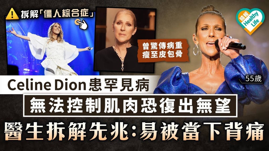僵人綜合症丨 Celine Dion患罕見病 無法控制肌肉恐復出無望 醫生拆解先兆：易被當成下背痛