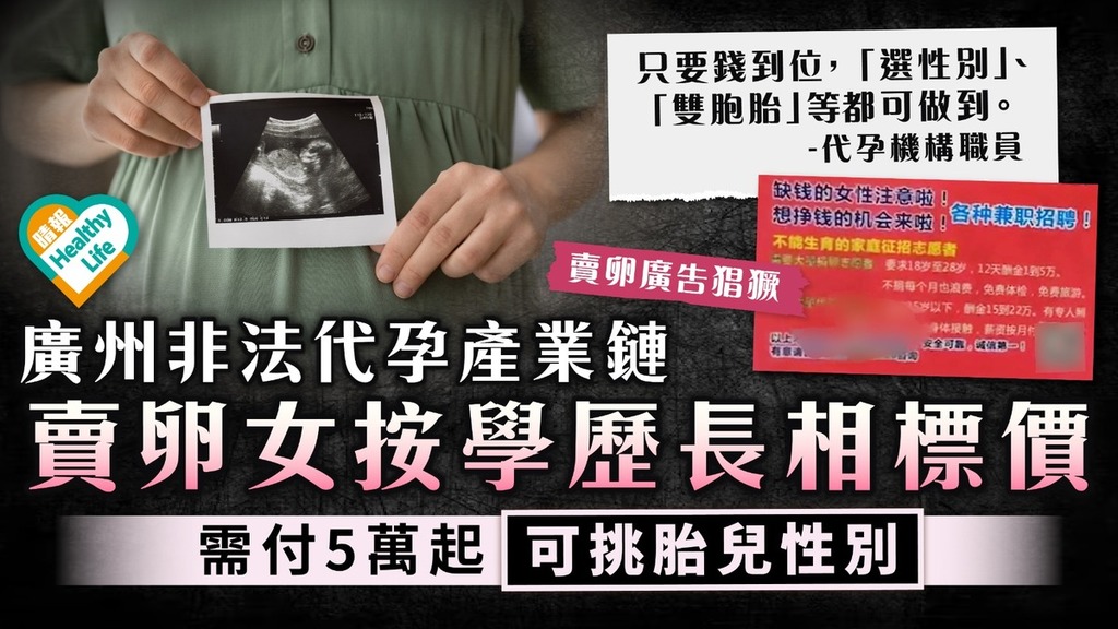 代孕一條龍丨廣州非法代孕產業鏈 賣卵女按學歷長相標價 付5萬起可挑胎兒性別