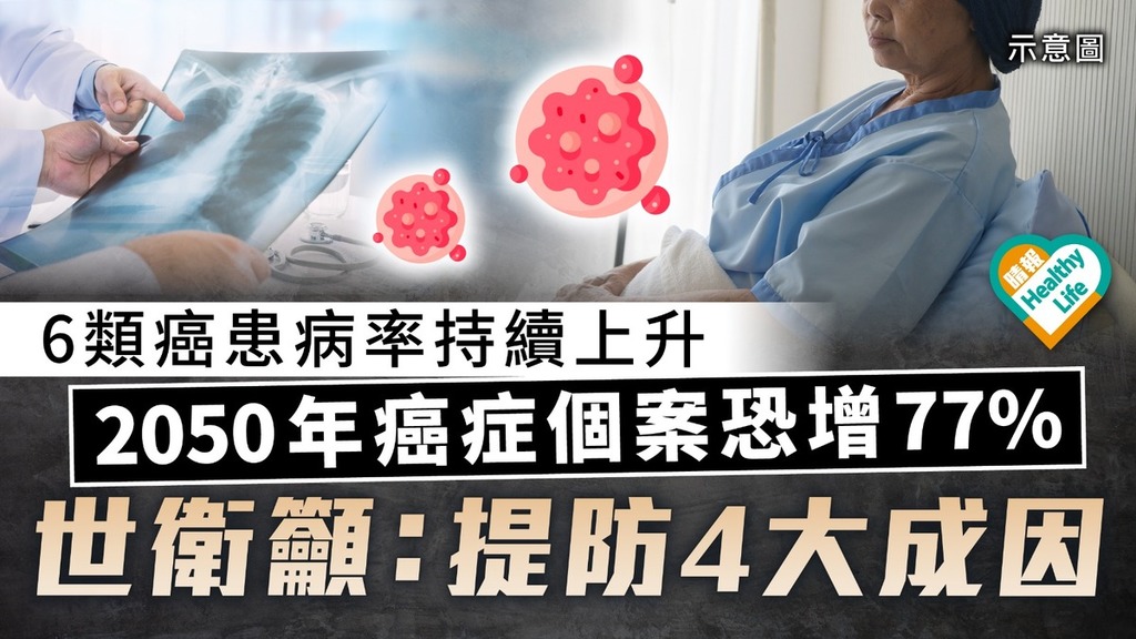 癌症殺手｜6類癌患病率持續上升 2050年癌症個案恐增77%  世衛籲：提防4大成因