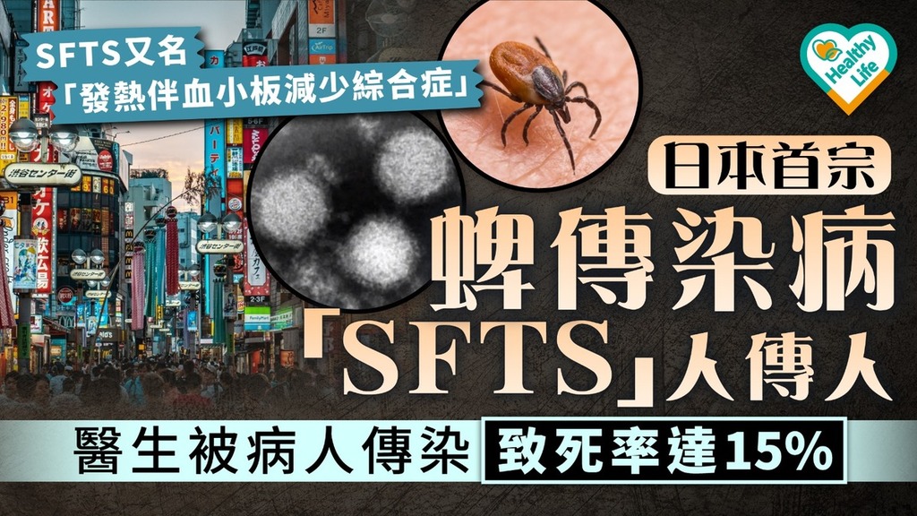 遊日注意｜日本首宗蜱傳染病「SFTS」人傳人 醫生被病人傳染致死率達15%