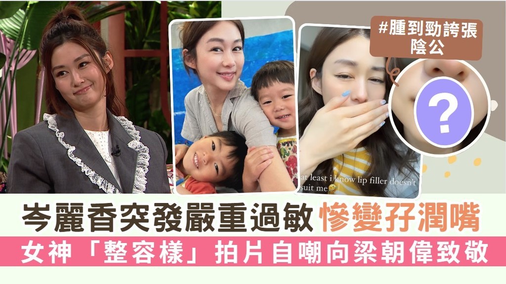 岑麗香突發嚴重過敏慘變孖潤嘴 女神「整容樣」拍片自嘲向梁朝偉致敬
