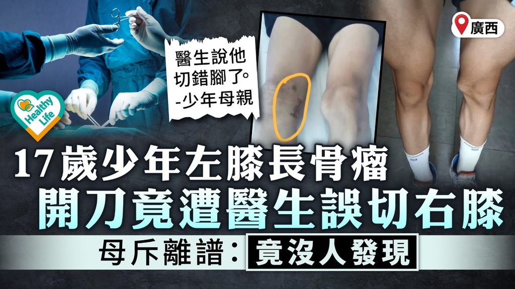 醫療事故｜17歲少年左膝長骨瘤 開刀竟遭醫生誤切右膝 母斥離譜：竟沒人發現