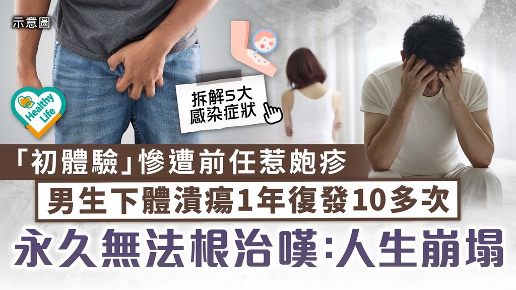 親密危機｜「初體驗」慘遭前任惹皰疹 男生下體潰瘍1年復發10多次 永久無法根治嘆：人生崩塌 