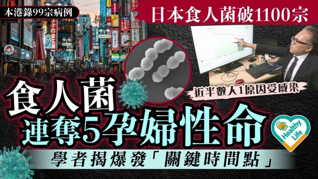 日本食人菌｜日本食人菌破1100宗 食人菌連奪5孕婦性命 學者揭爆發「關鍵時間點」