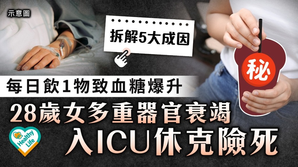 糖尿病｜ 每日飲1物血糖爆升 28歲女多重器官衰竭 入ICU休克險死