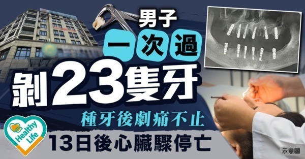 種牙危機｜男子一次過剝23隻牙 種牙後劇痛不止 13日後心臟驟停亡