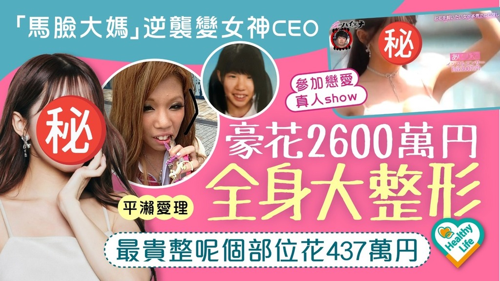 醜女大翻身｜「馬臉大媽」逆襲變女神CEO 豪花2400萬円全身大整形 最貴整呢個部位花437萬円