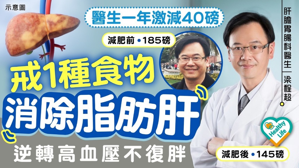 減肥大作戰｜醫生一年激減40磅 戒1種食物消除脂肪肝逆轉高血壓不復胖