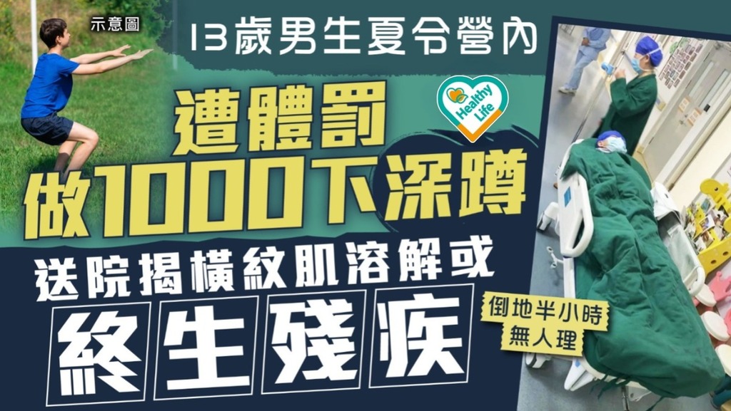 橫紋肌溶解症｜內地13歲男生夏令營被體罰做1000下深蹲 送院揭橫紋肌溶解或終生殘疾