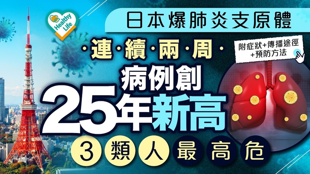 遊日注意｜日本爆肺炎支原體 連續兩周病例創25年新高 3類人最高危