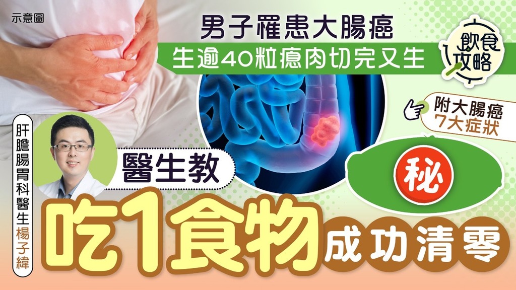 大腸癌｜男子罹患大腸癌生逾40粒瘜肉切完又生 醫生教吃1食物成功清零