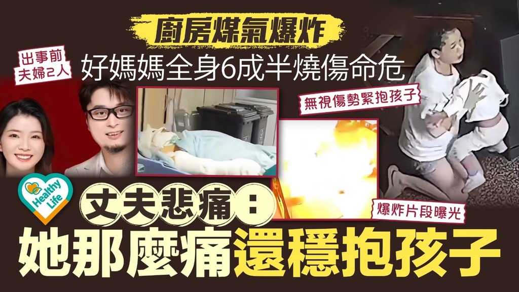 家居意外丨廚房煤氣爆炸好媽媽全身6成半燒傷命危 丈夫悲痛：她那麼痛還穩抱孩子